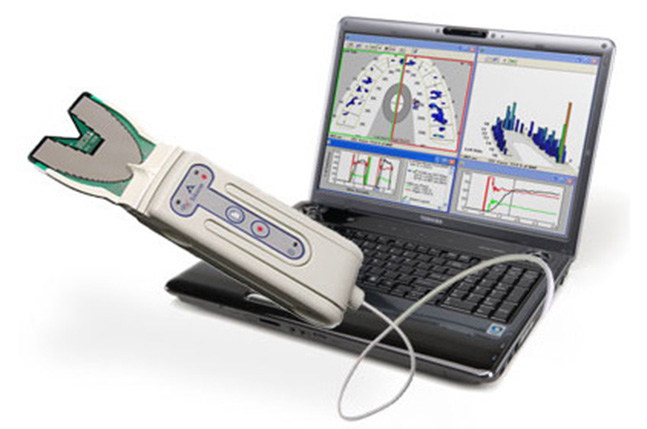 DIGITAL OCCLUSAL ANALYSIS